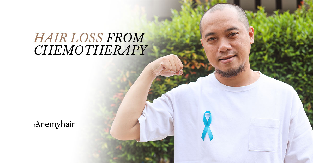 HAIR LOSS FROM CHEMOTHERAPY